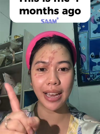 Embracing Confidence with Scars