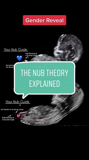 The Nub Theory Explained: Gender Prediction Kit for Accurate Results