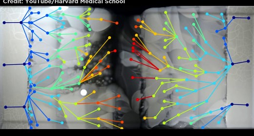 Terrifying video shows how bacteria becomes resistant to antibiotics