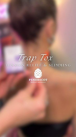 “Trap Tox” or “Barbie Botox” isn’t just for aesthetics (hello, sleek neckline 👋), it can also help relieve that heavy, tense feeling in your shoulders. Whether you’re here for pain relief, posture, or a little extra elegance, this treatment is a game-changer. Have questions? Leave them below and we’ll come back with answers ✨ Our Providers ✨ 👩🏽‍⚕️Dr.Freese @jfreese10 👩🏼‍⚕️Nurse Kim @kimweeksfit_rn 👩🏼‍⚕️Nurse Haylee @hayleepacheco 👩🏽‍⚕️Nurse Kelsy @aesthetixx_femme_rn 👩🏽‍⚕️Aesthetician