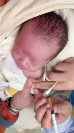Cute baby Crying vaccination injection ❤️💉