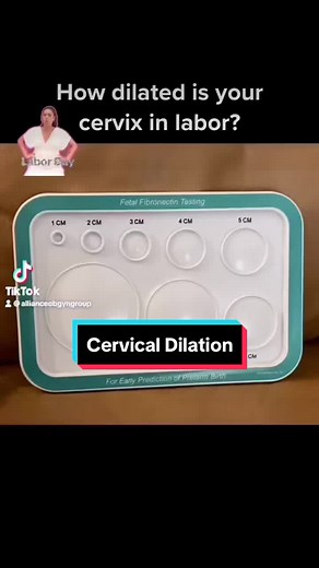 Understanding Cervical Dilation for Labor and Delivery