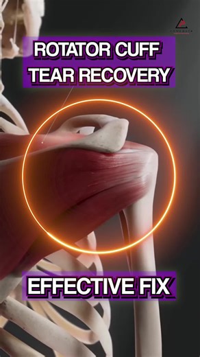 🔥 Rotator Cuff Rehab That Actually Works 🔥 Still doing basic banded external rotations and wondering why your shoulder still hurts? It’s time to challenge your cuff the way it actually works. ❌ The Real Problem: Isolated Rotation Isn’t Enough – The cuff doesn’t just spin the arm—it keeps the shoulder centered while you move, rotate, and reach. No Scapular Control – If your scapula isn't moving well, your cuff is working overtime to keep the joint stable. Missing Dynamic Stability – Real life =