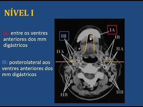 IMAGINOLOGIA LINFONODOS CERVICAIS