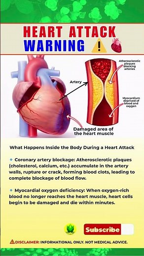 Why Heart Attacks Happen — And How to Prevent Them