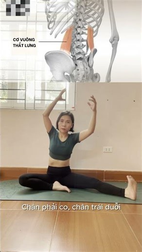 NGÀY 17/ĐAU LỆCH 1 BÊN THẮT LƯNG/GIÃN CƠ VUÔNG THẮT LƯNG