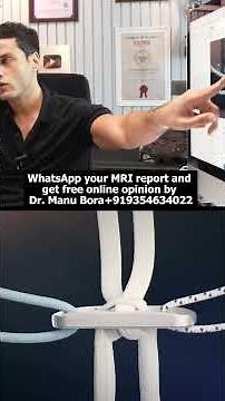 ACL Tear का Failure Rate इतना ज़्यादा क्यों है ? #aclrecovery #acltear #acltreatment #acl