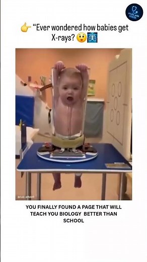 👉 “How Do Babies Get X-Rays? 👶🩻 (Must Watch!)| Baby Care & Medical Facts #mbbs #baby #xray #babycare