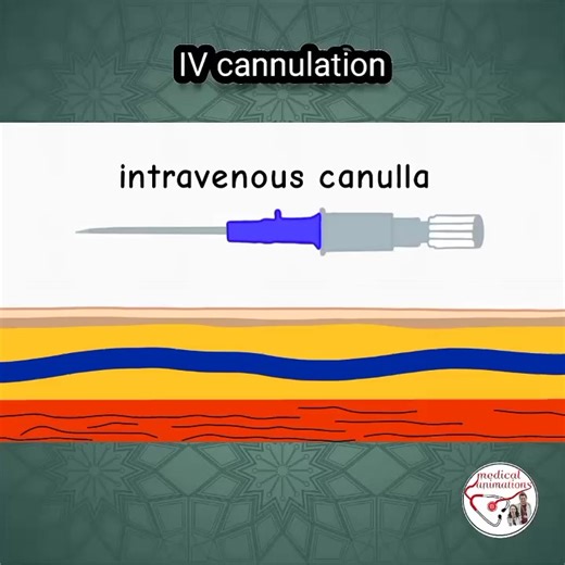 Intravenous _ IV Animation #Brilliantnurses