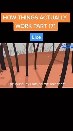 #fyp #fy #fypシ #foryoupage #foryourpage #howthingswork #howthingsactuallywork #trending #lice #hair #hairstyle #liceremoval #licetok #haircut