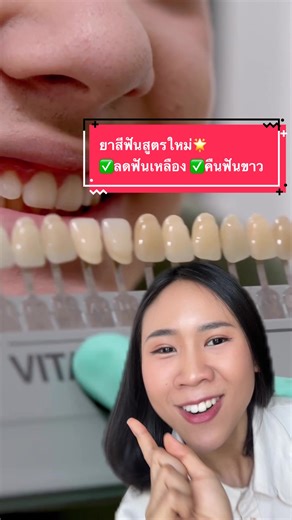 ลดฟันเหลือง คืนฟันขาว เลือกยาสีฟันสูตรใหม่ เพื่อดูแลสุขภาพฟัน #SensodyneClinicalWhite #ฟันขาวชัวร์ไม่กลัวเสียวฟัน #ซิดนีย์sydney #วิทยาศาสตร์ร่างกาย #กรีนสกรีนวิดีโอ