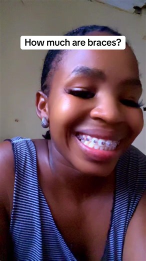 Understanding the Cost of Braces: What to Expect