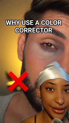 IF YOU HAVE DARK CIRCLES DO THIS 👉🏾