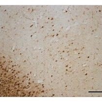 视频: 脑染色：神经组织的组织学染色