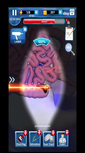 😱😱Open surgery , removing appendix 😱😱#medical #surgery #animated