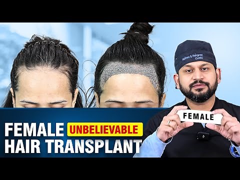 Female Hair Transplant Surgery Explained by Dr. Ankit Jain at Hairfree & Hairgrow Clinic