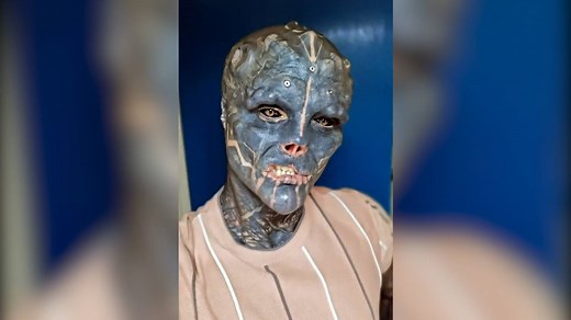 Dieser Mann wird zu einem «Black Alien» : So sah er früher aus
