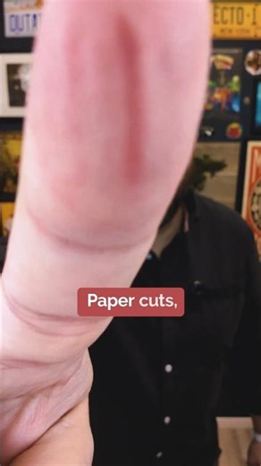 Why do paper cuts hurt so much? #thinkbigger #papercuts