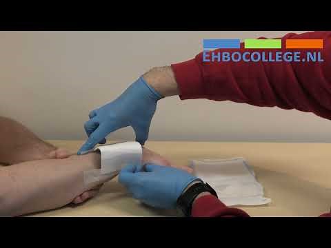 Bedekken van een open botbreuk