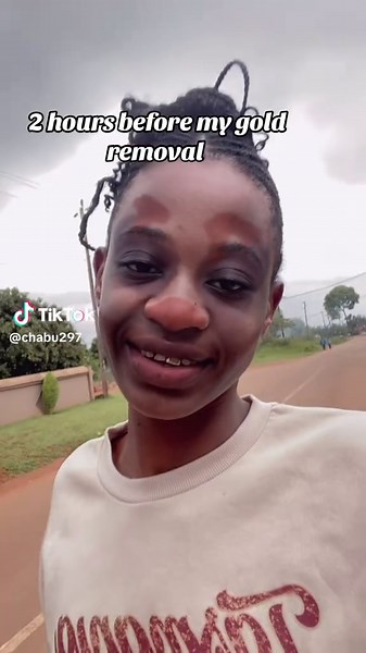 Gold Removal Experience: A Student's Journey