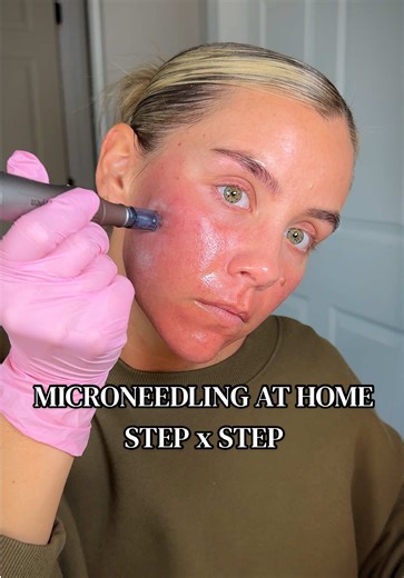 Microneedling at Home: A Beginner's Guide