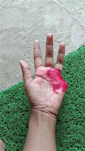 pinky finger cut magic ✨ but it's viral funny tricks