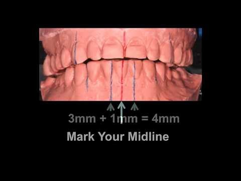 Determining Canine Guidance - Dr. Brian Mills