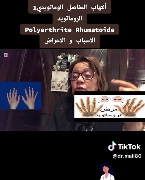 #CapCut #fyp #صحة_الرجل #صحة_المرأة #صحة_عامة #polyarthriterhumatoide #polyarthrite #الروماتويد