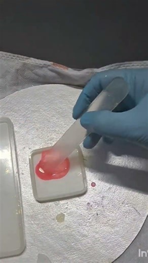 hack for using bumpy mould