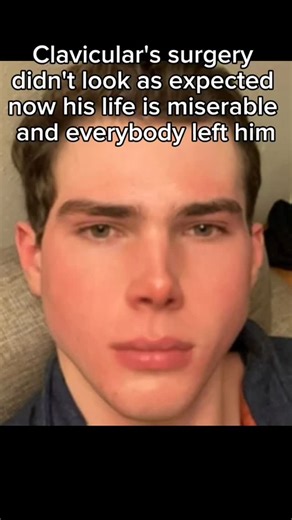 @shaded.blizz | 💔 . . . . . . . #looksmax #looksmaxx #jordanbarrett #chicolachowski #mewing #jawline #glowup #bonesmashing #mogger #mogged #blackpill... | Instagram