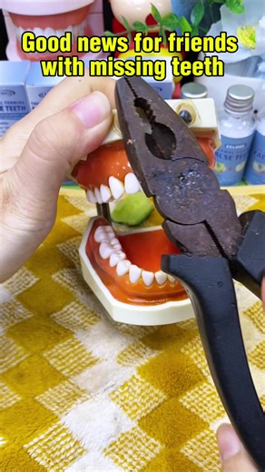 Self Repair Missing Teeth with Temporary Dental Adhesive