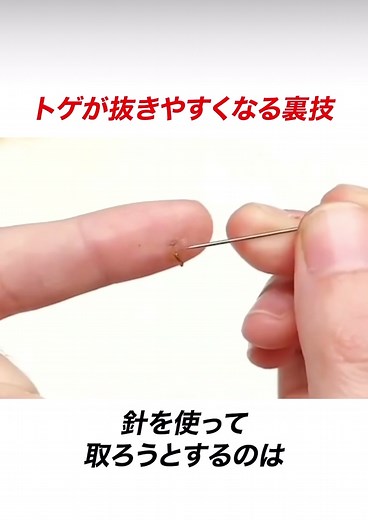 指に刺さったトゲを簡単に抜く方法