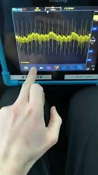 How to perform a alternator AC Ripple test using a oscilloscope Peugeot 1.6 hdi #shorts