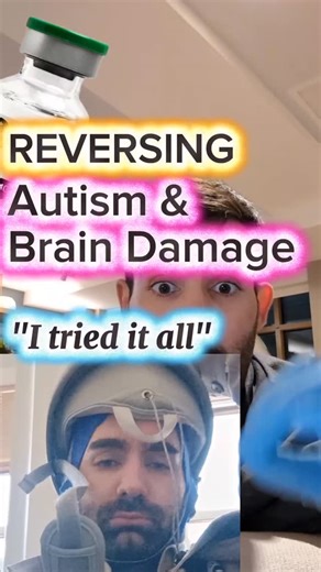 Salem Savage | The Ultimate Brain Reset: TBI, Autism, & Stroke After 15 concussions and a suicide attempt last August, I rebuilt my brain with Dihexa.... | Instagram