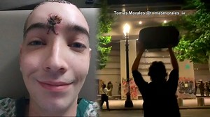 Judge rules protester can't sue US Marshal who shot him in face with non-lethal munition