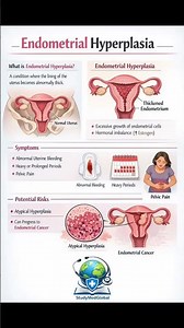 Endometrial Hyperplasia. #studymedglobal #medstudent #futuredoctor #viral