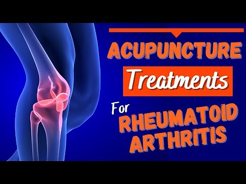 How To Effectively Manage Rheumatoid Arthritis With Acupuncture & Chinese Medicine #acupuncture
