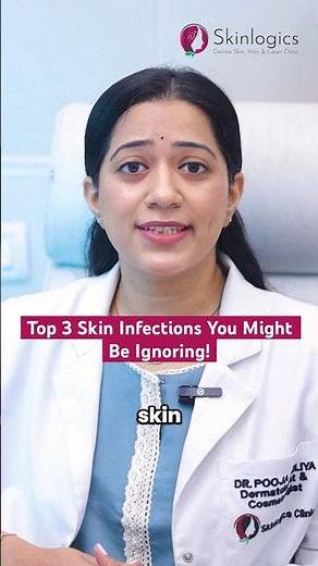 Types of Skin Infection | Skin Infection Treatment | Best Skin Doctor in Noida | Skinlogics Clinic