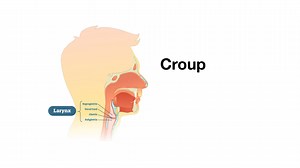 Sounds of Croup (Laryngotracheitis) - Lung Sounds - MEDZCOOL.mp4