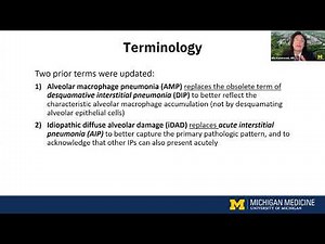 Updates in the Diagnosis and Treatment of Interstitial Lung Disease
