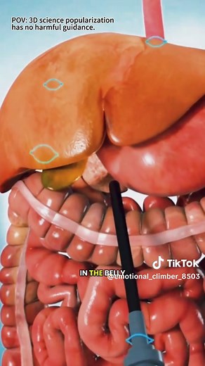 Understanding Gallbladder Removal Surgery and Recovery