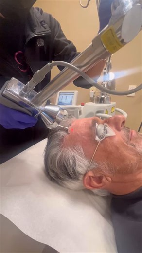 My Profractional laser skin resurfacing journey. Like everyone else, I love the sun! I use hats and sunscreen but still get damage from the sun. Though microdermabrasion, microneedling, BBL, and chemical peels are incredibly effective for rejuvenation and skin maintenance, The Sciton Erbium YAG Profractional laser delivers the most powerful treatment for solar damage. #profractional #sciton #scitonbbl #skin | Philip Schoenfeld