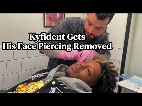 Getting my face piercing removed!