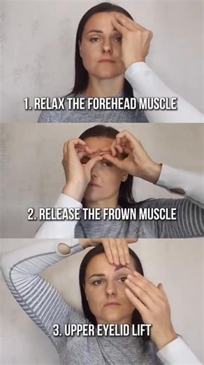 ✨ WORKING ON UPPER FACE REJUVENATION ✨ I’m often asked how to naturally lift the upper face — without injections or surgery. Here’s a simple breakdown I use in my osteopathic work: 1. Forehead muscle release – helps reduce horizontal lines and relax overall tension in the forehead. 2. Corrugator muscle work – smooths the area between the eyebrows and releases deep stress patterns. 3. Upper eyelid lift – opens the eyes, lifts sagging lids, and creates a more refreshed look. These 3 steps together