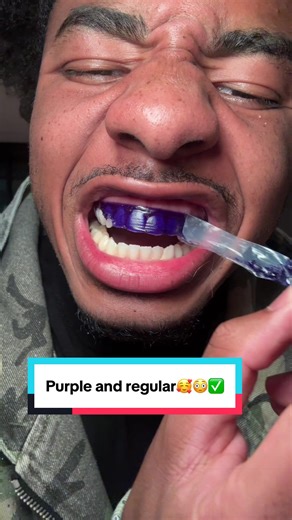 Transform Your Smile with Teeth Whitening Strips