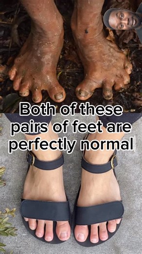The Rainforester on Instagram: "Indigenous peoples of Ecuador 🇪🇨🌱 #Huaorani #Waorani #Tribe #Feet #Amazonia #Amazonriver #Ecuador #Adaptation #Evolution #Humanevolution #History #Monkey #Monkeysofinstagram #QuentinTarantino #Culture #indigenous #Indigenouslivesmatter #indigenouspeople #indigenouswomen #Indigenousrights #Indigenouspride #Indigenousculture #Zoology #Zoologist #Anthropology #Anthropologist"