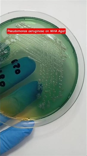 Pseudomonas aeruginosa on MHA Agar#pseudomonas#microbiology#biology