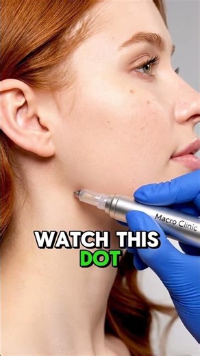 Is This The Most HYPNOTIC Blackhead Removal on the Internet?! (You Be the Judge)