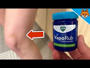 11 New (Secret) Wick VapoRub Tricks Everyone Needs to Know💥(Brilliant)🤯