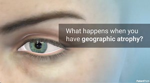 What is Geoatrophy? - Eyetube